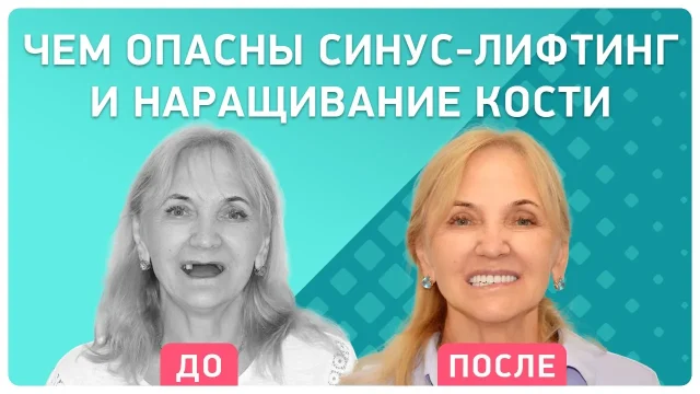 Зубной ряд как парабола