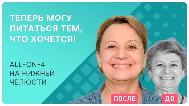 Зубной ряд как парабола