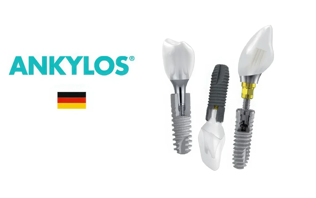 Ankylos: импланты для All-on-6
