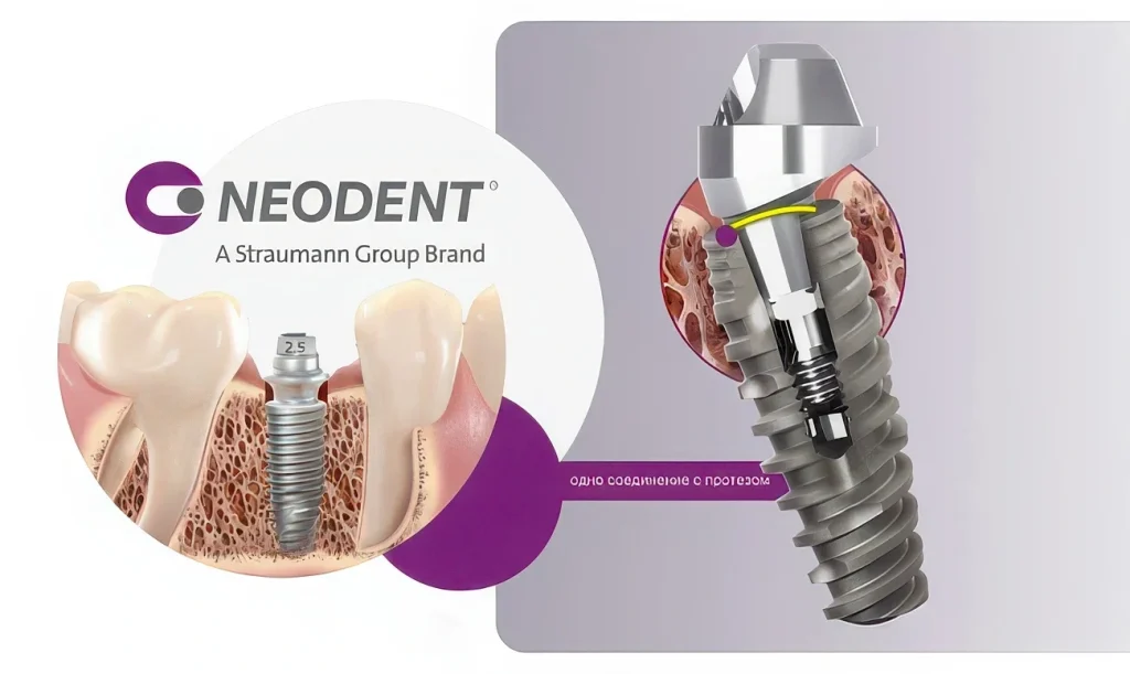 Имплантаты Neodent